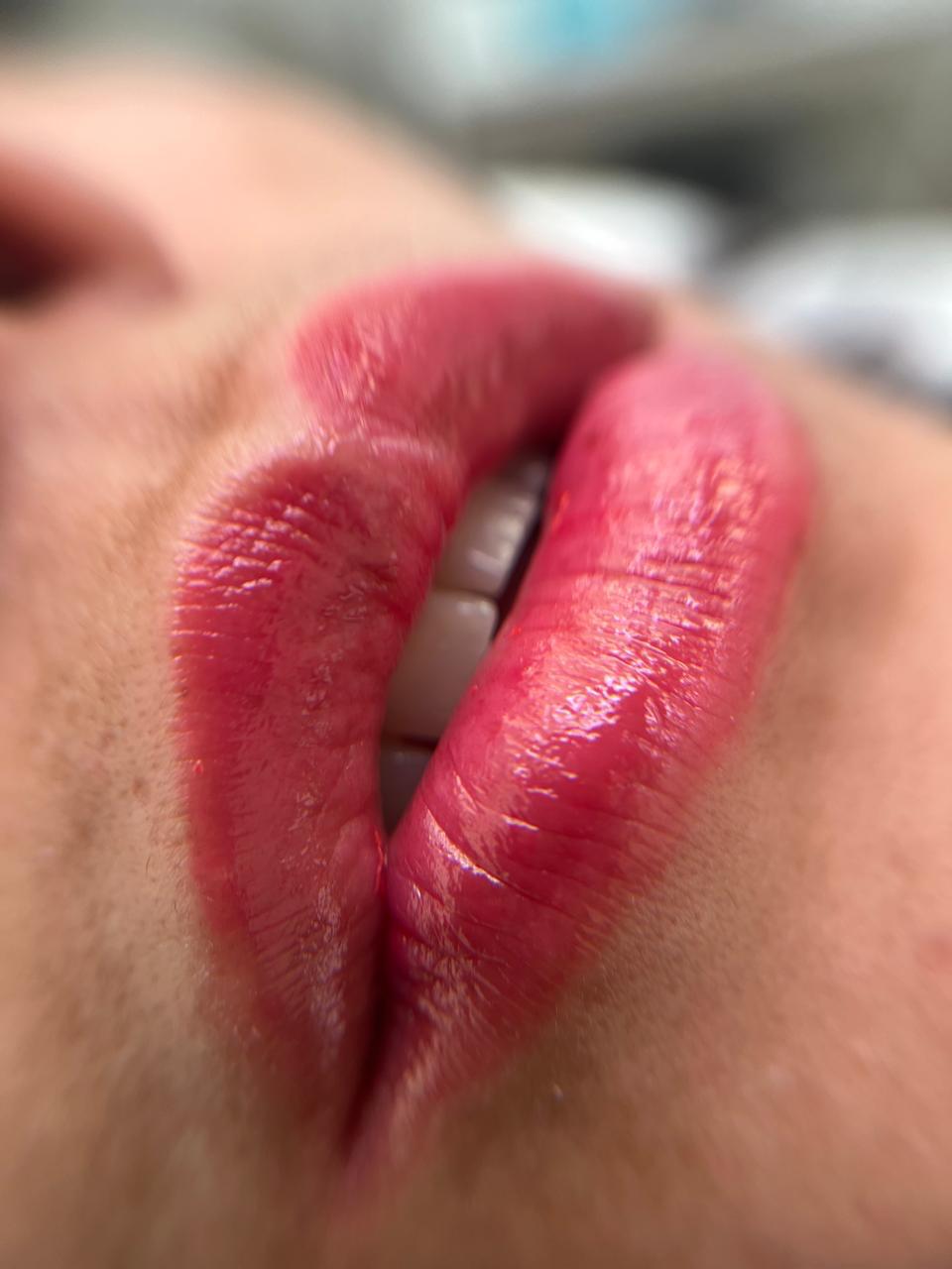 Resultado Hydragloss